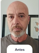 Foto anterior al uso de NOVARE